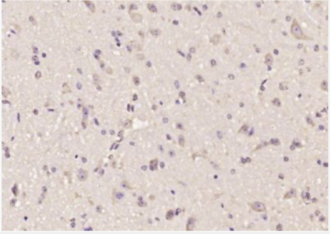 Anti-AOC1 antibody-阿米洛利结合蛋白1抗体,AOC1