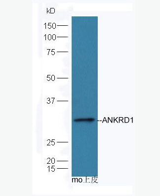 Anti-ANKRD1 antibody-心肌锚蛋白重复结构域1抗体,ANKRD1