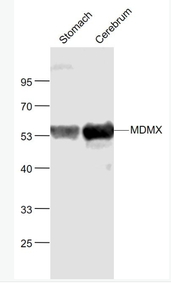 Anti-MDMX antibody-MDM2样P53蛋白结合抗体,MDMX