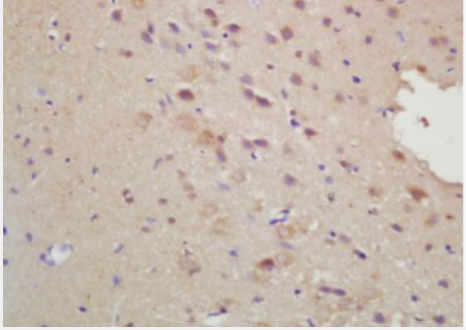 Anti-FbxO6 antibody-F-box蛋白相關(guān)蛋白6抗體,FbxO6