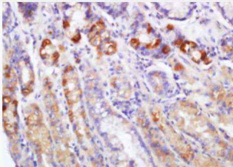 Anti-EDA2R antibody-肿瘤坏死因子受体超家族成员27抗体,EDA2R