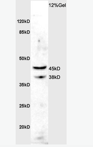 Anti-ASMTY antibody-松果體N甲基乙酰羥色胺抗體,ASMTY