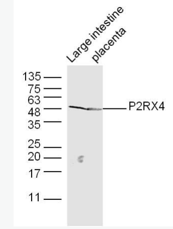 Anti-P2RX4 antibody-三磷酸腺苷门控阳离子通道蛋白抗体,P2RX4