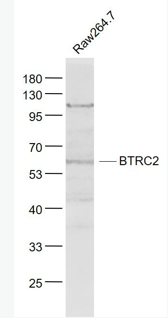 Anti-BTRC2 antibody-BTRC2蛋白抗体,BTRC2