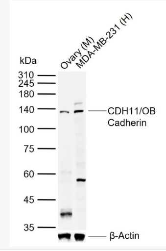 Anti-CDH11/OB Cadherin antibody-钙粘附蛋白-11抗体,CDH11/OB Cadherin