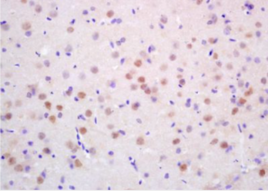 Anti-CDC10 antibody-细胞周期调控因子10抗体,CDC10