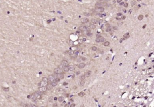 Anti-Ube2G1 antibody-泛素蛋白连接酶G1抗体,Ube2G1