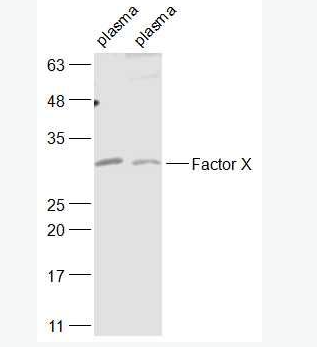 Anti-Factor X antibody-凝血因子10抗体,Factor X