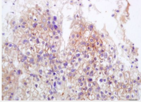 Anti-MICB antibody-MICB抗體,MICB