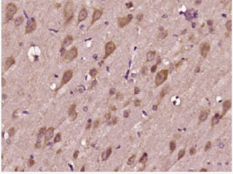 Anti-RNF142 antibody-環(huán)指蛋白142抗體,RNF142