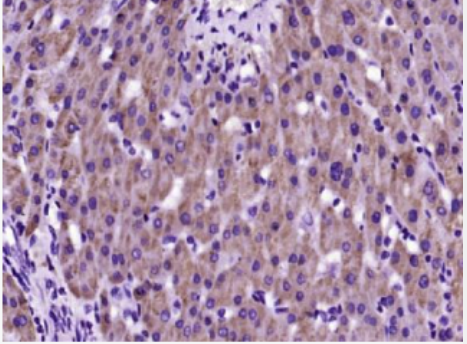 Anti-SARM1 antibody-SARM蛋白抗体,SARM1