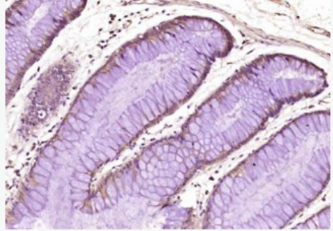 Anti-USP10 antibody-去泛素酶10抗體,USP10