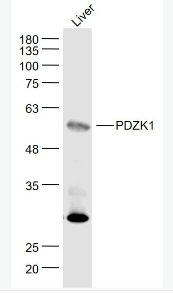 Anti-PDZK1 antibody-PDZ结构域PDZK1蛋白抗体,PDZK1