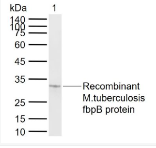Anti-fbpB antibody-结核分枝杆菌Ag85B/fbpB抗体,fbpB