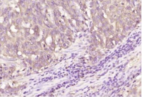 Anti-TENM3 antibody-固生蛋白3抗體,TENM3