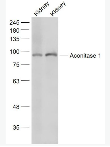 Anti-Aconitase 1 antibody-鐵調(diào)節(jié)蛋白1抗體,Aconitase 1