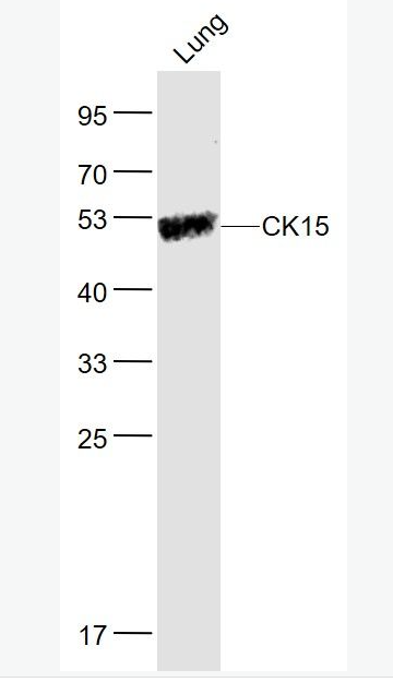 Anti-CK15 antibody-细胞角蛋白15抗体,CK15