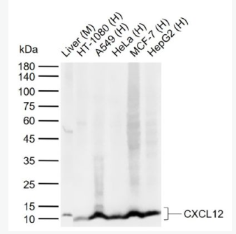Anti-CXCL12 antibody-基质细胞衍生因子1抗体,CXCL12