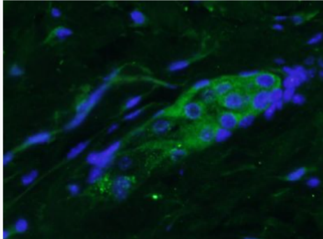 Anti-FGF18 antibody-成纤维细胞生长因子18抗体,FGF18