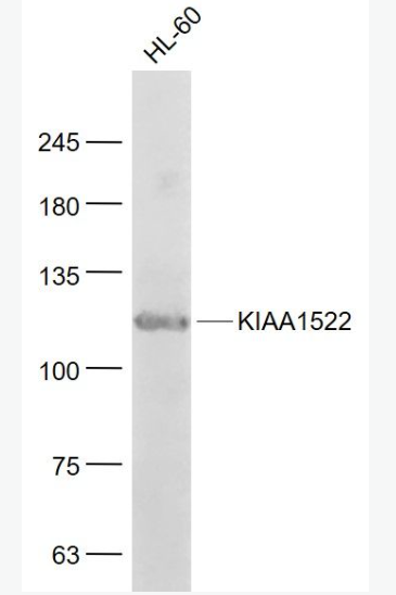 Anti-KIAA1522 antibody-KIAA1522蛋白抗体,KIAA1522