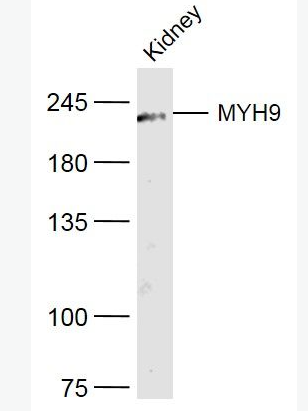 Anti-MYH9 antibody-肌球蛋白重链9抗体,MYH9