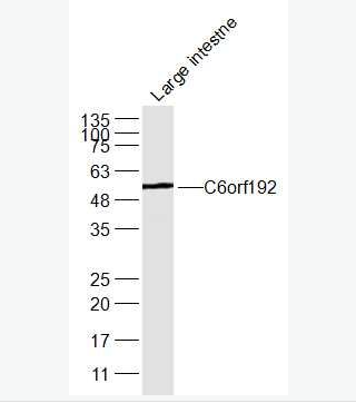 Anti-C6orf192 antibody-8号染色体开放阅读框192抗体,C6orf192