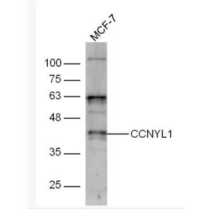 Anti-CCNYL1 antibody-周期素样Y1抗体,CCNYL1