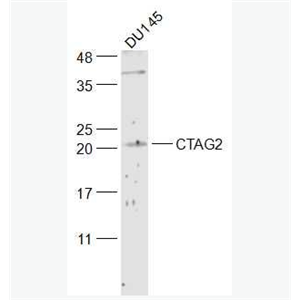 Anti-CTAG2 antibody-肿瘤/睾丸抗原2抗体