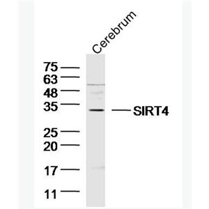 Anti-SIRT4 antibody-沉默调节相关蛋白4抗体