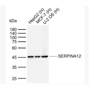 Anti-SERPINA12 antibody-内脏脂肪组织源性丝氨酸蛋白酶抑制蛋白抗体
