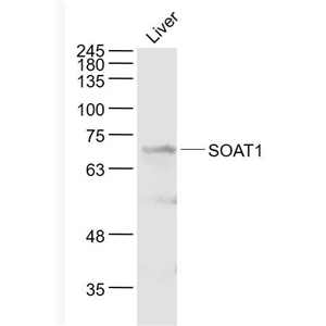 Anti-SOAT1 antibody-胆固醇酰基转移酶1抗体