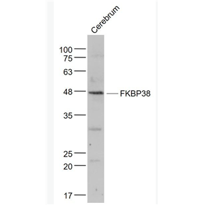 Anti-FKBP38 antibody-FK506结合蛋白38抗体