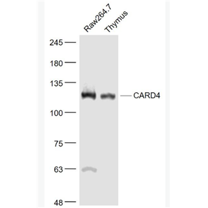 Anti-CARD4 antibody-凋亡加强结构域蛋白4抗体
