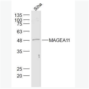 Anti-MAGEA11 antibody-黑色素瘤相关抗原11抗体