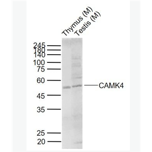 Anti-CAMK4 antibody-钙/钙调蛋白依赖性蛋白激酶4抗体,CAMK4