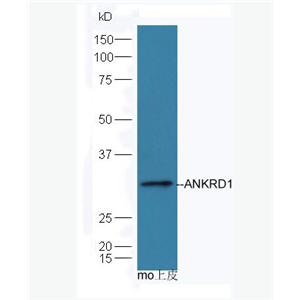 Anti-ANKRD1 antibody-心肌锚蛋白重复结构域1抗体