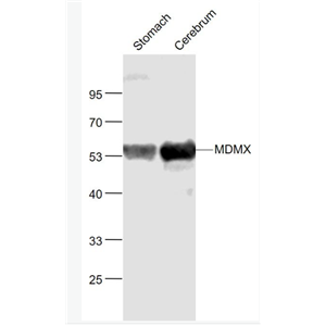 Anti-MDMX antibody-MDM2样P53蛋白结合抗体