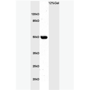 Anti-BHLHE41 antibody-BHLHE41抗体