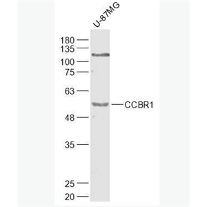 Anti-CCBR1 antibody-钙离子通道阻端耐药蛋白CCBR1抗体