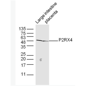 Anti-P2RX4 antibody-三磷酸腺苷门控阳离子通道蛋白抗体,P2RX4