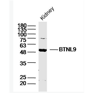Anti-BTNL9 antibody-嗜乳脂蛋白样9抗体,BTNL9