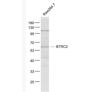 Anti-BTRC2 antibody-BTRC2蛋白抗体
