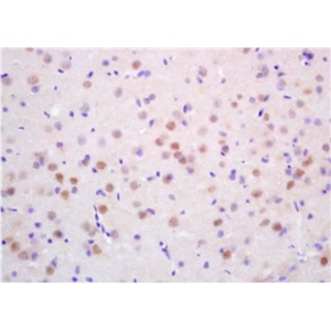 Anti-CDC10 antibody-细胞周期调控因子10抗体,CDC10