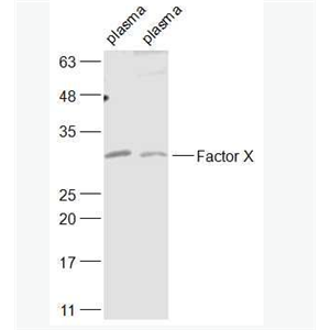 Anti-Factor X antibody-凝血因子10抗体
