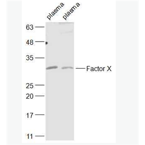 Anti-Factor X antibody-凝血因子10抗体,Factor X