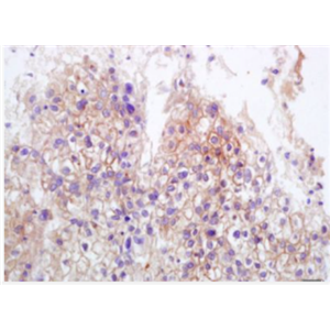 Anti-MICB antibody-MICB抗體,MICB