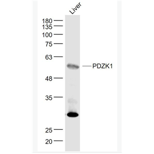 Anti-PDZK1 antibody-PDZ结构域PDZK1蛋白抗体