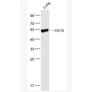 Anti-CK15 antibody-细胞角蛋白15抗体