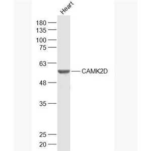 Anti-CaMKII delta antibody-钙/钙调素依赖蛋白激酶2D(CaMKIIδ)抗体