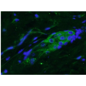 Anti-FGF18 antibody-成纤维细胞生长因子18抗体